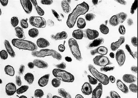 Coccobacilli (Gram Negative Bacteria) - Laboratoryinfo.com