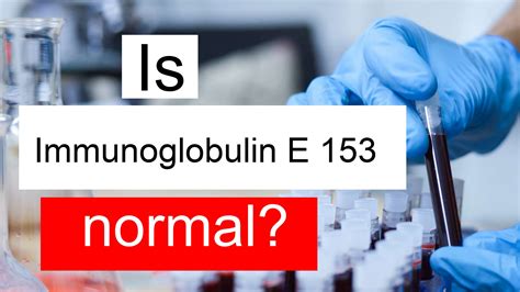 Is Immunoglobulin E 153 normal, high or low? What does IgE level 153 mean?