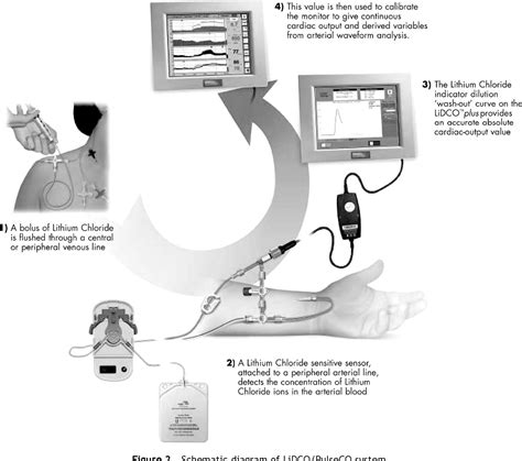 Figure 2 from Non-invasive cardiac output monitoring. | Semantic Scholar