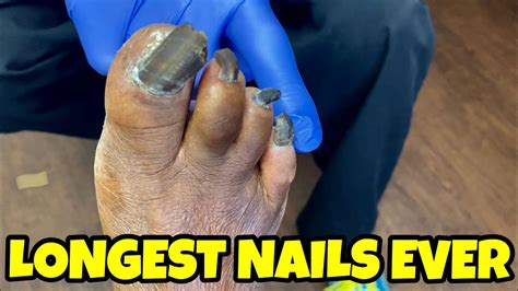 Guinness World Record For Longest Toenails - Nail Ftempo