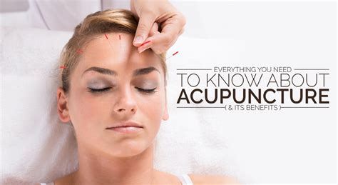 Acupuncture and its amazing benefits – Gurugram Naturopathy Cure Centre