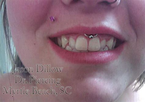 smiley piercing (labial frenulum) | Dr. Piercing | Pinterest