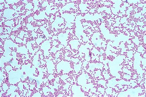 Pseudomonas aeruginosa Gram Stain | microbekeeper | Flickr