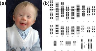 Birth Defects: Causes and Statistics | Learn Science at Scitable