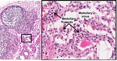 Reticular Connective Tissue Lymph Node