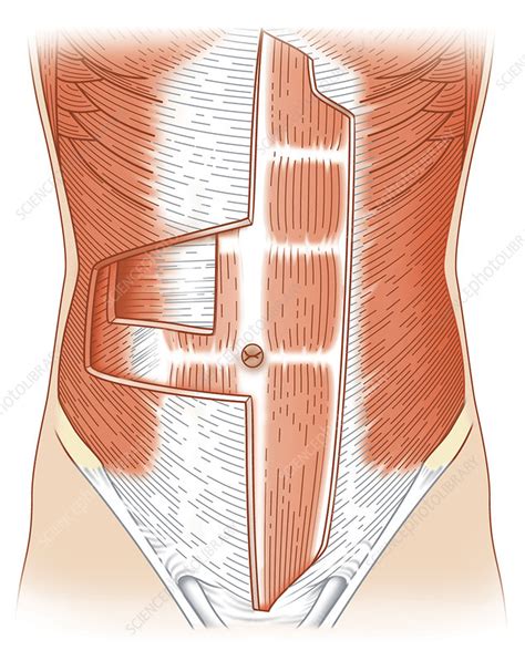 Abdominal muscle layers, artwork - Stock Image - C010/7080 - Science ...