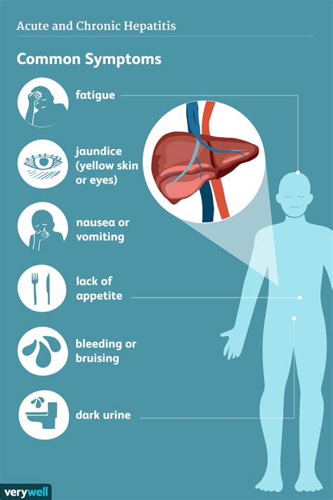 Hepatitis C Symptoms and Complications