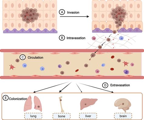 The process of tumor metastasis. Tumor metastasis is complex and ...