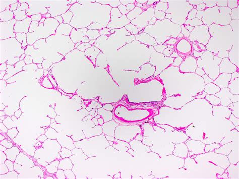 Bronchus And Bronchiole Histology