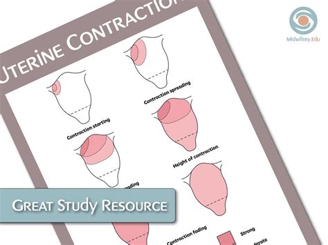 Uterine Contractions Educational Poster - Etsy