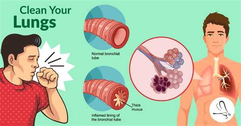 How to Get Rid of Phlegm and Mucus in Chest & Throat (Instant Relief ...