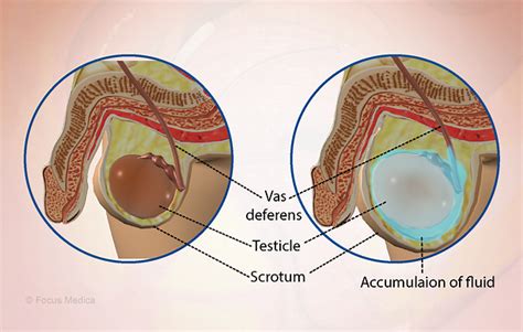 Health Condition : Symptoms, Causes, Treatment and More