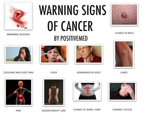 Warning Signs of Cancer You Don't Want to Ignore