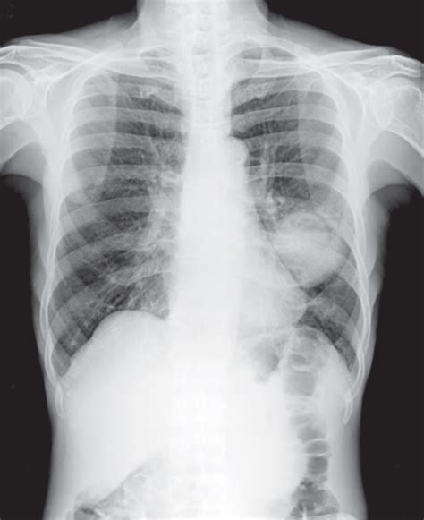 Study Medical Photos: A 60 year old man presents with cough not ...