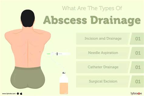 Abscess Drainage: Causes, Symptoms, Treatment and Cost