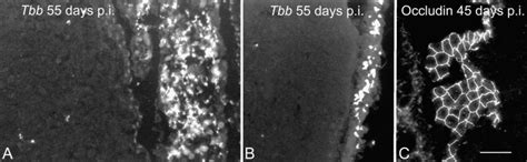 Photomicrographs from the level of the septal nuclei with an ...