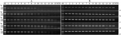 DNA electrophoresis | PLOS ONE