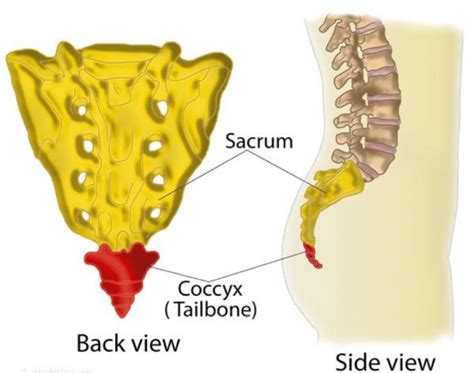 What is Coccydynia? - Toronto — Proactive Pelvic Health Centre