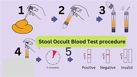 Stool occult blood test procedure step by step in lab