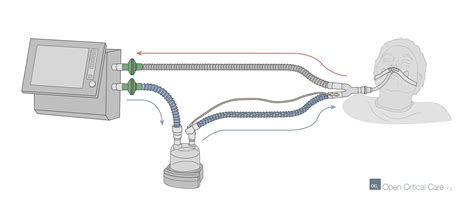 Dual limb ventilator circuit with active heat and humidification - Open ...