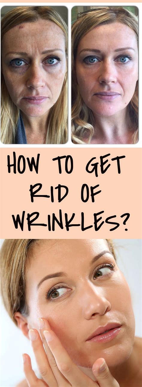 How To Get Rid Of Wrinkles? - Active Blab | Anti aging skin treatment ...