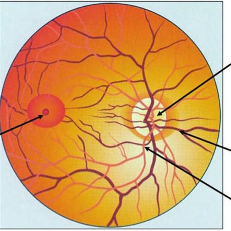 Normal ocular fundus. | Download Scientific Diagram