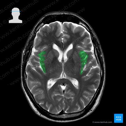 Insula: Anatomy, function, connections, clinical points | Kenhub