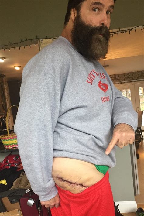 Mick foley shows off gnarly scar following hip surgery. - scoopnest.com