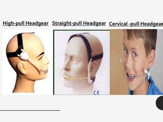 Headgear | PPT