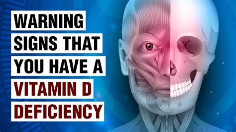 14 Signs Of Vitamin D Deficiency | Patient Talk