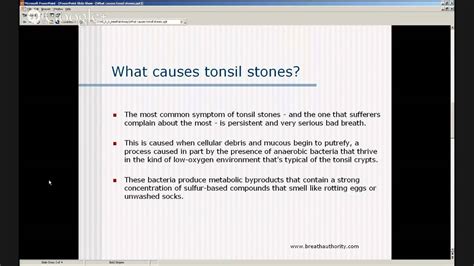 Tonsil Stones Causes - What Causes Tonsil Stones? - YouTube