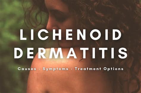 Lichenoid Dermatitis: Causes, Symptoms, Treatment Options