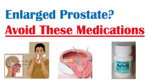 Medications to Avoid with Enlarged Prostate | Reduce Symptoms and Risk ...