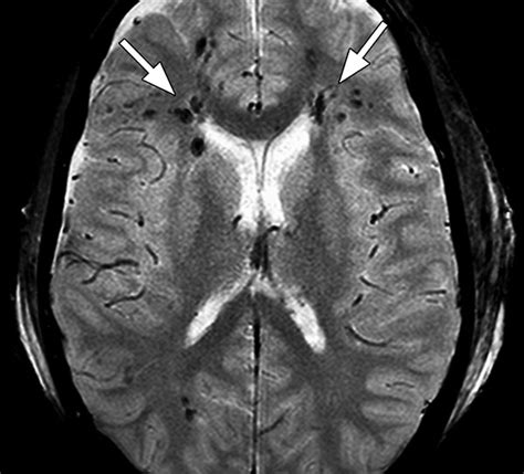 Advanced Neuroradiological MRI: A Medical Imaging Aid for the Detection ...