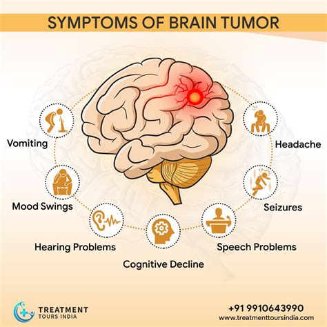 Symptoms Of Brain Tumor In Female - BRAINLYXA