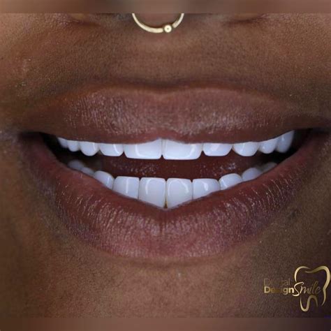 Gallery - Dental Design Smile