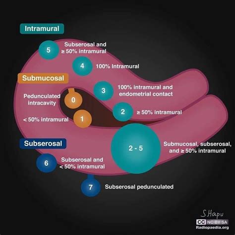 Pin by Jesus Solorio Berber on Radiología | Medical ultrasound ...