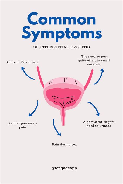 Interstitial cystitis symptoms and causes – Artofit