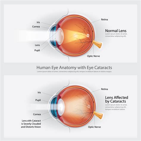 Eye Anatomy Chart