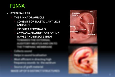 SOLUTION: Basic ear anatomy - Studypool