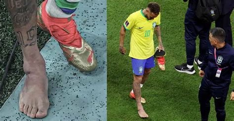 Blow for Brazil, Neymar ruled out for at least two matches with injury