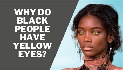 Why Do Black People Have Yellow Eyes? - BlacksHome