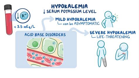 Approach to hypokalemia: Clinical sciences - Osmosis Video Library