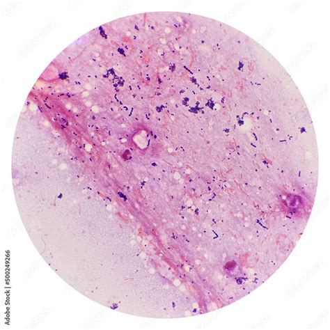 Cocci and bacilli bacteria in urine under 100X light microscope. Smear ...