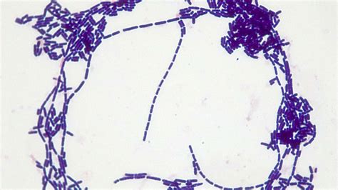 Micrograph Bacillus subtilis Gram stain 1000x p000010 | OER Commons