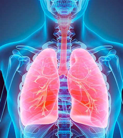 What Can a Lung CT Scan Detect? - Preventative Diagnostic Center