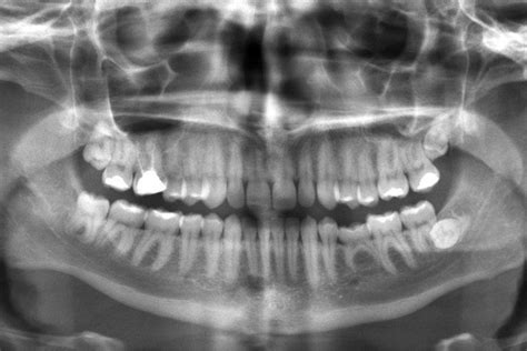 What You Should Know About Dental X-Rays: Nicole Mermet, DMD: Dentist