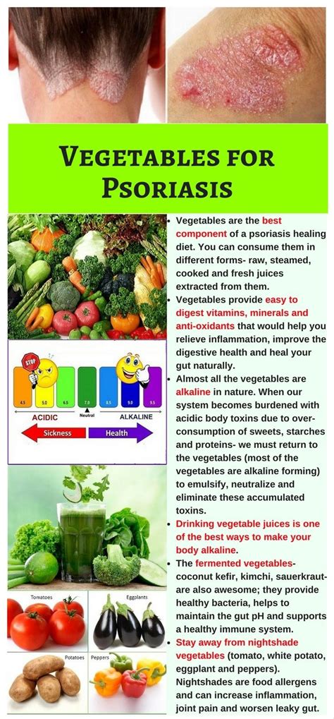 Vegetables are the best ingredients of a Psoriasis healing diet. They ...