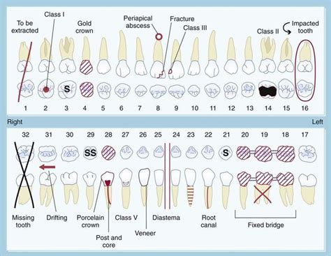 image - #Image | Dental charting, Dental hygiene student, Dental anatomy