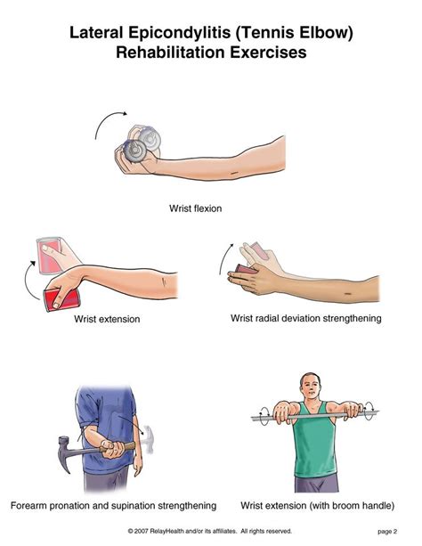 Lateral Epicondylitis Exercises